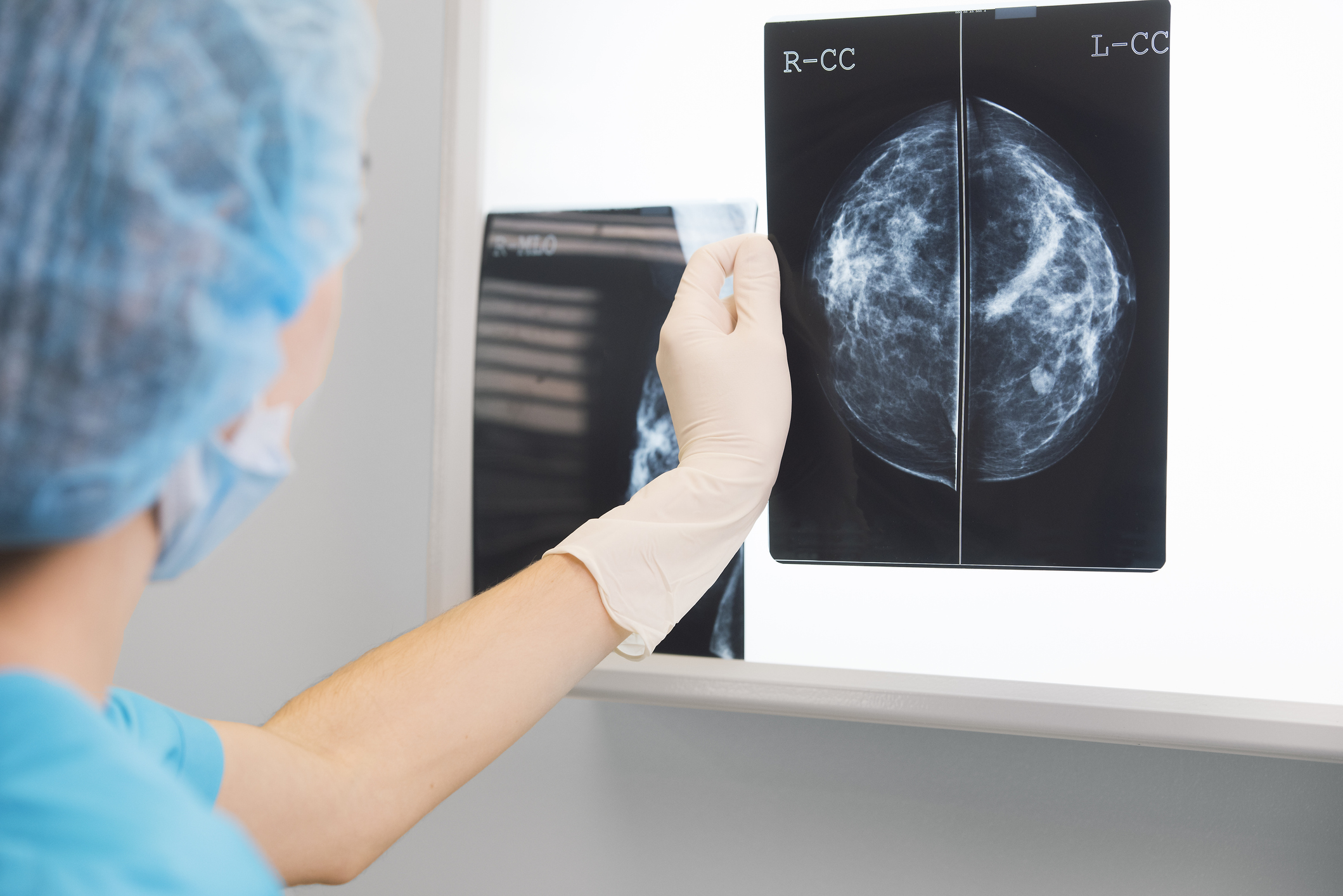 Mekanism som kan hindra tillväxt av bröstcancer identifierad